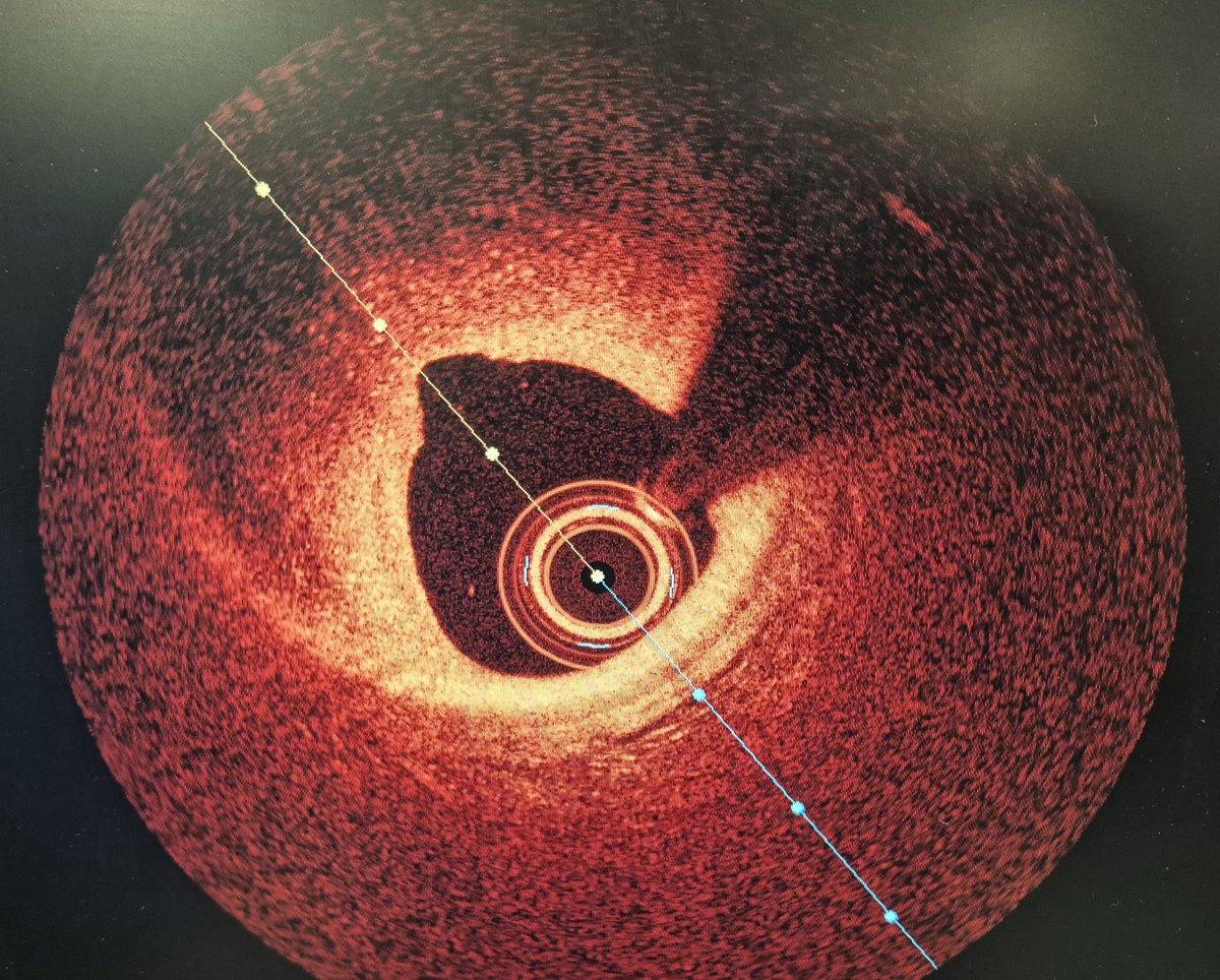 Elad Asher tweet media