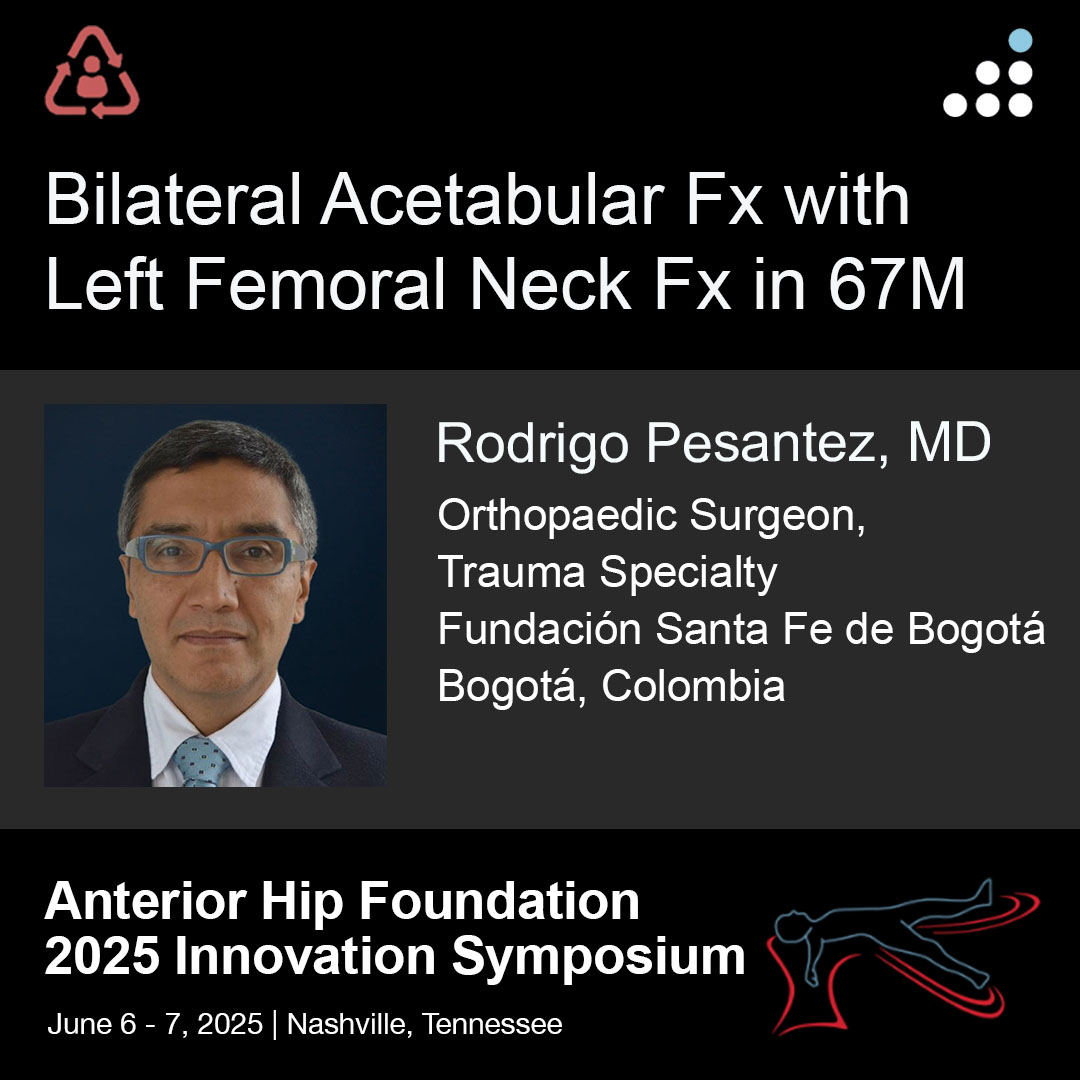 orthobullets's tweet photo. Here are intra-op & post-op of images of Procedure 1 (1 of 2) of yesterday's case by Dr. Rodrigo Pesantez and Fundación Santa Fe de Bogotá (@FSFB_Salud)

BILATERAL ACETABULAR FX WITH RIGHT FEMORAL NECK FX IN 67M

Procedure 1 (posted today): Left Acetabular FX ORIF + Left THA
Procedure 2 (posting tomorrow): Right Acetabular FX ORIF + Right THA

Here is the link to the pre-op imaging: https://t.co/3nBy6e7d83

Leave a comment and keep the great conversation going! #orthotwitter

Please contribute to our community and vote on this case on OB: https://t.co/OGZdYpwm85