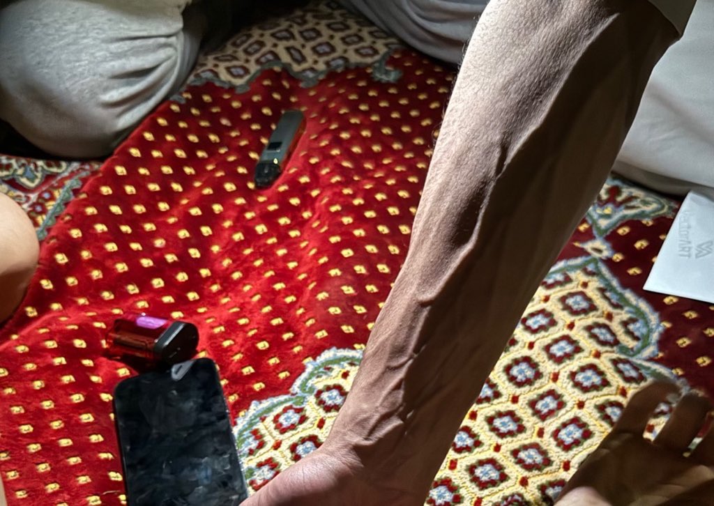 dcbd69's tweet image. العافية رجعت قليلًا 💪