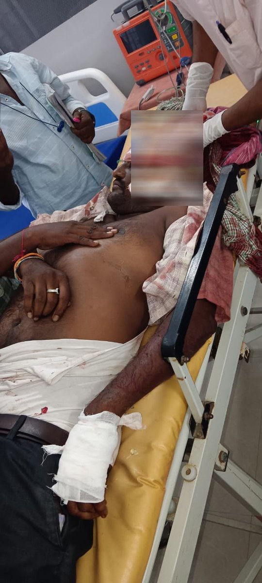 JaiTDP's tweet photo. జగన్ రెడ్డి ఆదేశాలతో, ఓటమిని జీర్ణించుకోలేక బరి తెగిస్తున్న వైసిపి సైకోలు. పత్తికొండలో వేట కొడవళ్ళతో ఎమ్మెల్యే కేఈ శ్యాం బాబు వర్గీయుడి పై దాడి చేసి టీడీపీ నేత గిరినాథ్ ని హత్య చేసిన మాజీ ఎమ్మెల్యే కంగాటి శ్రీదేవి వర్గీయులు. వేట కొడవళ్ళతో నరికి చంపిన వైసిపి సైకోలు.
#YSRCPRowdyism 
#EndOfYCP 
#AndhraPradesh