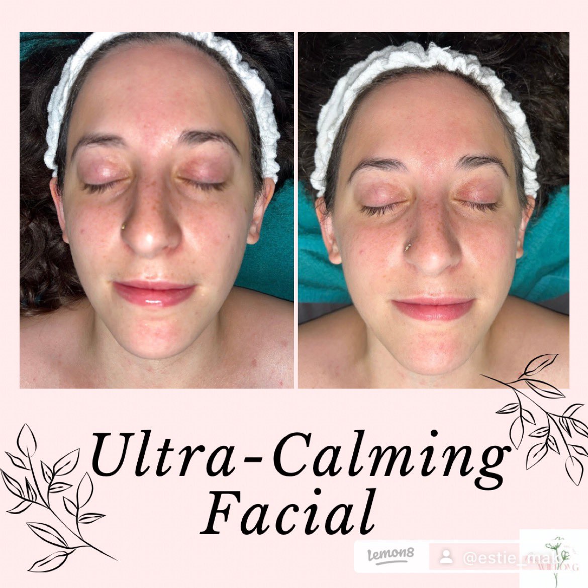 Makshroomm's tweet photo. The @dermalogica utlra-calming line is my favorite can’t you tell? I used it again in my dear friend Courtney how’s known to have sensitive skin. She is prone to acne so I used the age bright clearing serum!
#esthetician #dermatologia #facial #sensitiveskin #acne #stundent https://t.co/OMi8NEuXJ2