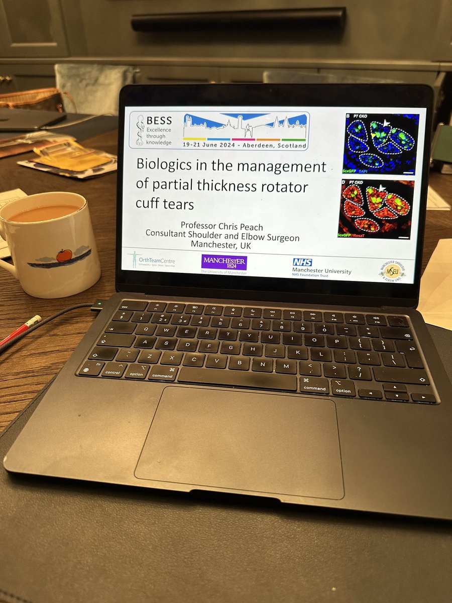 Chris Peach (@drpeachy) on Twitter photo Just putting the finishing touches to my talk for <a href="/bessconference/">British Elbow & Shoulder Society</a> 2024 in Aberdeen
I will be sharing the stage with @shoulderdoc007 and Ellie Richardson in our symposium about management of the tricky partial thickness rotator cuff tears on Day 1
#bess2024 Just putting the finishing touches to my talk for <a href="/bessconference/">British Elbow & Shoulder Society</a> 2024 in Aberdeen
I will be sharing the stage with @shoulderdoc007 and Ellie Richardson in our symposium about management of the tricky partial thickness rotator cuff tears on Day 1
#bess2024
