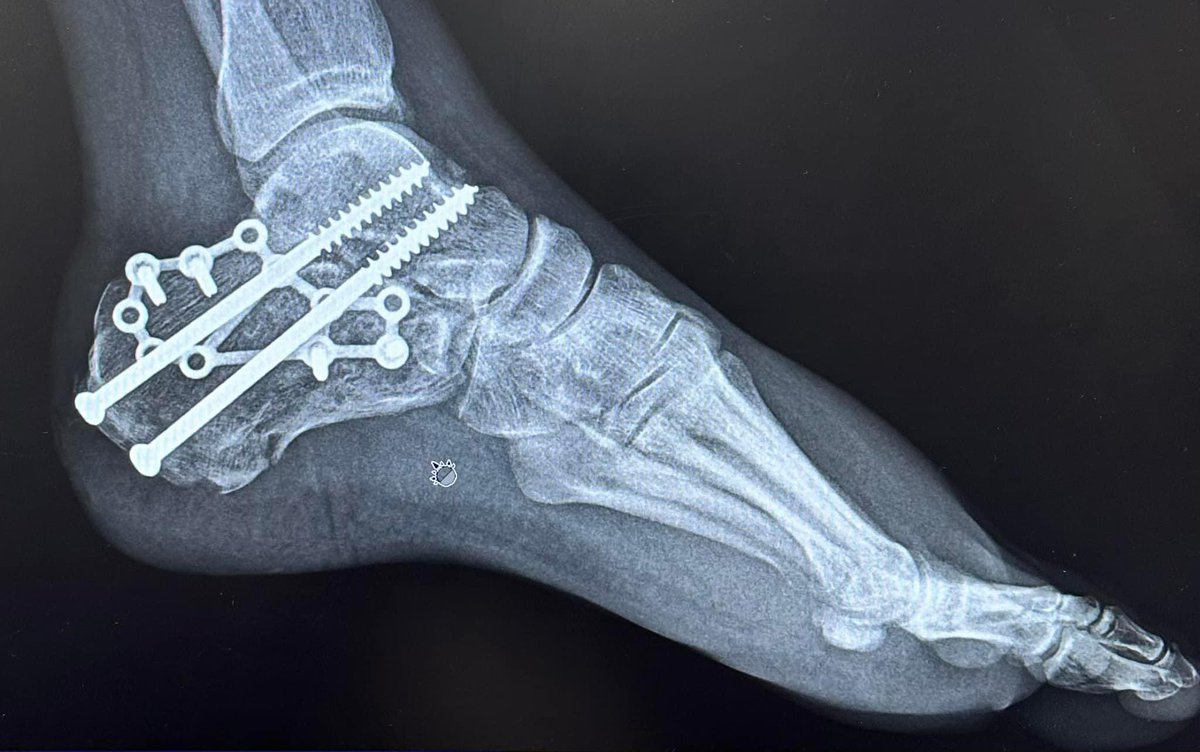 darinnei's tweet photo. I need some help from @LornaShore. I need a ticket the OKC show. I shattered my heel in a bad accident and Pain Remains is the only thing that has kept me sane. My recovery goal is the show in OKC but they are sold out. https://t.co/W6a1LOBAxB
