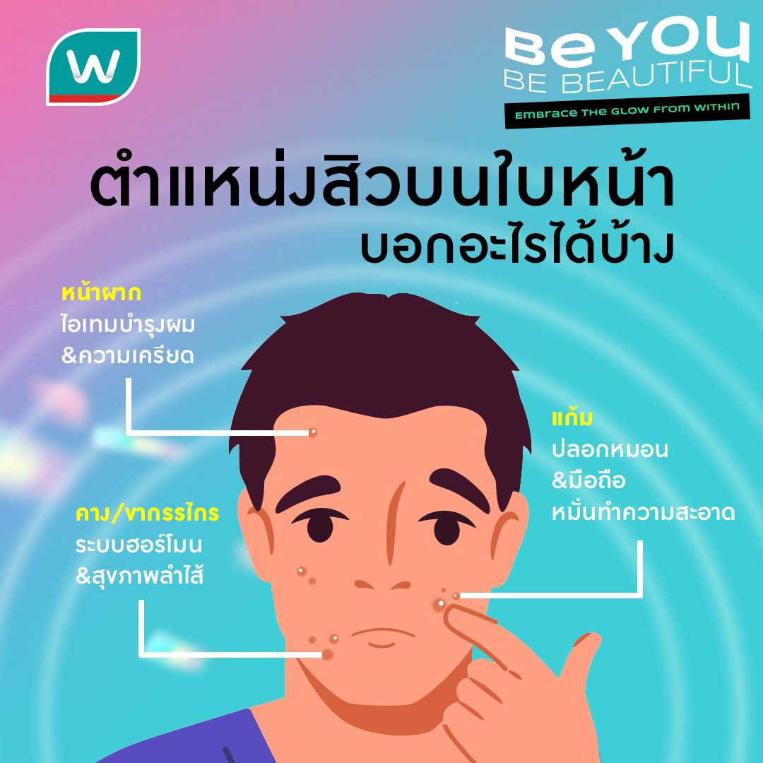WatsonsThailand's tweet photo. คำว่าสิว พูดเบาๆก็เจ็บ 💥ตำแหน่งสิวบนใบหน้า แท้จริงแล้ว กำลังบอกอะไรเราอยู่ มาเช็กกันเลย!

#BeYouBeBeautiful
#WatsonsTH #watsonsbeautytips
#Acne https://t.co/62S4GgJWnG