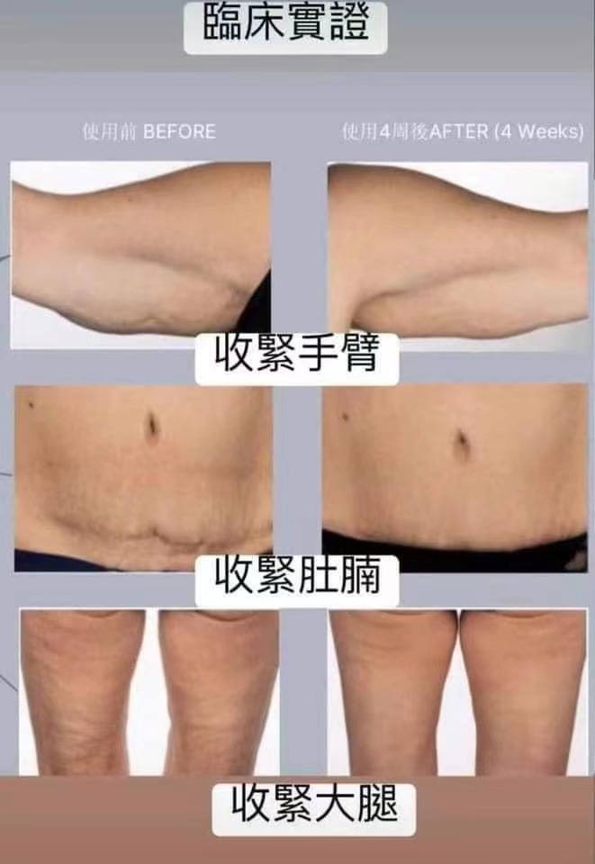 JennYNGKALENG's tweet photo. 3 funtions in 1 device,
got awards,

more information:
https://t.co/tpqAzOhCTQ

~ add me in facebook to get a discount ~
https://t.co/m1AbWVZV8E

leave a massage "from X" to get discount. https://t.co/dumFypozby