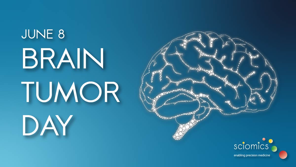 Brain tumors are among the most complex and challenging forms of cancer, affecting people of all ages. 
Increased awareness can lead to earlier diagnosis, improved treatment outcomes, and better support for patients and their families. 🔬
#cancerresearch #cancer #braincancer