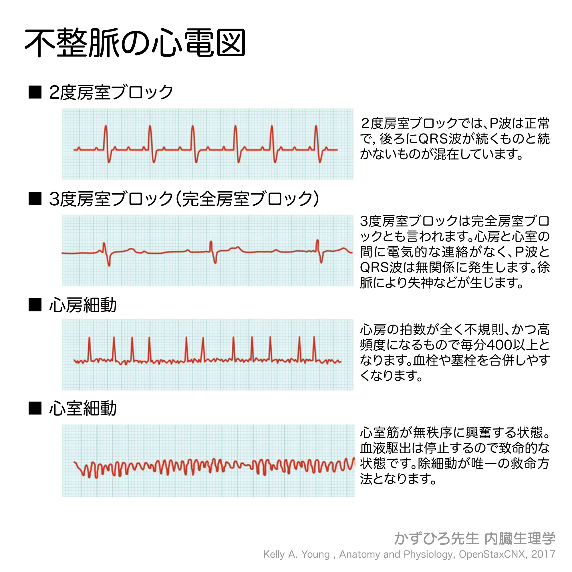 不整脈診療　ロジック　プラクティス Amazon.co.jp: 不整脈診療ロジック×プラクティス : 加藤 武史