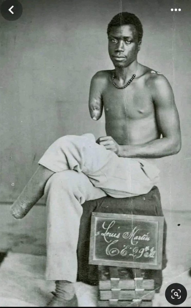 AareAraa's tweet photo. Leopold, who was the colonial ruler  in Congo used to cut the limbs of Congolese people when they don’t produce the estimated rubber per day. At the end of his rule in Congo, he killed about 15 million Congolese by murdering them and also causing famine and starvation. https://t.co/g6mODn06VP