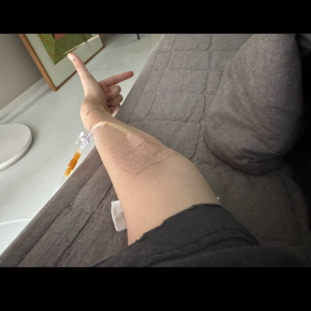 puppiesbreads's tweet photo. baekhyun was given an IV drip due to fatigue and fever when he finished their last fanmeeting and it turns out he wasn't paid at all????? 😭😭😭😭😭 https://t.co/500pDfikRA