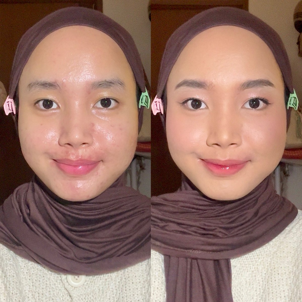 cloudysnowys's tweet photo. makeup sat set tapi hasilnya ✨CAKEP✨ banget ini gapake concealer or foundation😭🤍

gila sih coveragenya oke pool nutupin darkspot &amp; redness, ga kerasa dempul atau berat...

OILY ACNE PRONE SKIN APPROVED🙏🏻 https://t.co/Ez1nRvXjlY
