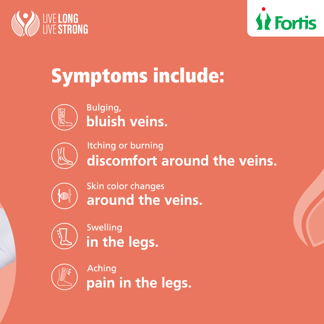 fortis_hospital's tweet photo. Varicose veins usually develop on the legs and thighs.
They are generally harmless but can become painful and tender when swollen.
If you face any of these symptoms, reach out to us.
#LiveLongLivestrong #AtFortisWeCare #FortisHealthcare #VaricoseVeins #Knots https://t.co/6bXdFMj7qN
