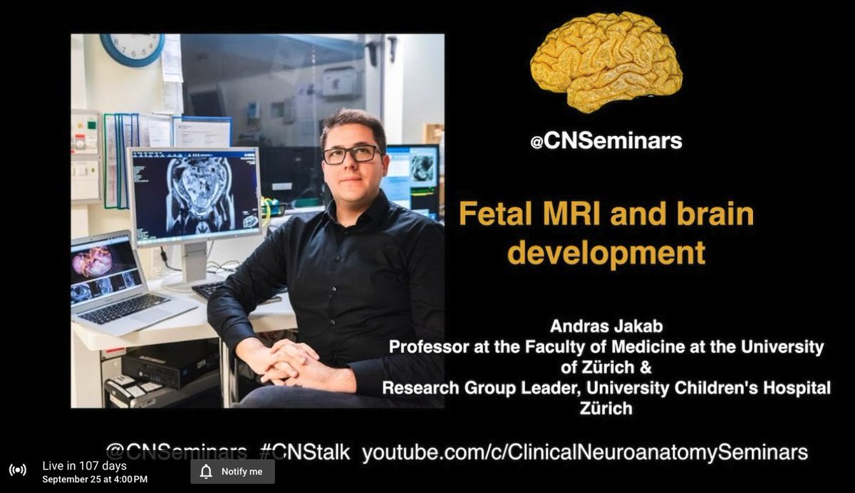 Save the Date:

We will be back with the next #CNStalk in September with <a href="/AndrasJakabMD/">Tiny Human Brains</a> talking about his fantastic work on #Fetal #MRI and brain #development 

Sign up here: youtube.com/live/mzDwvlSsQ…