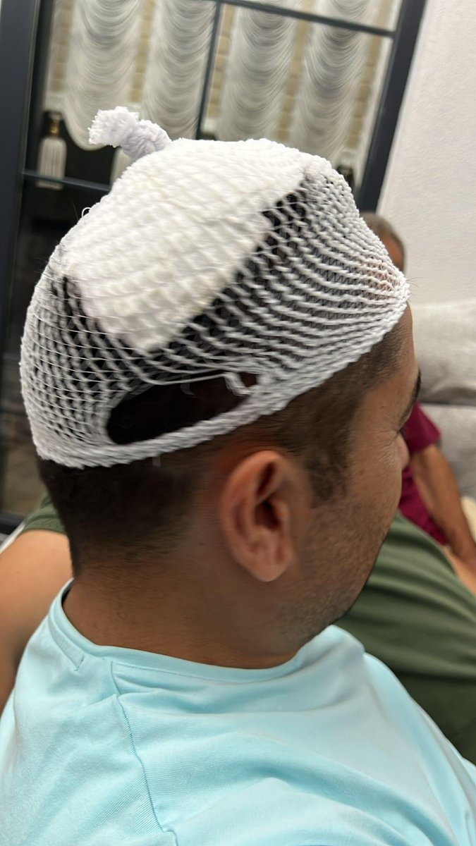 Samsun İli Çarşamba İlçe Tarım ve Orman Müdürlüğünde görevli Veteriner Sağlık Teknikeri Halil İbrahim Ak, programlı
şap aşılama çalışması sırasında köpek salırısına uğradı. Hastaneye kaldırılıp gerekli müdahalesi yapılan meslektaşımızın genel sağlık durumu iyidir. 

Kendisine