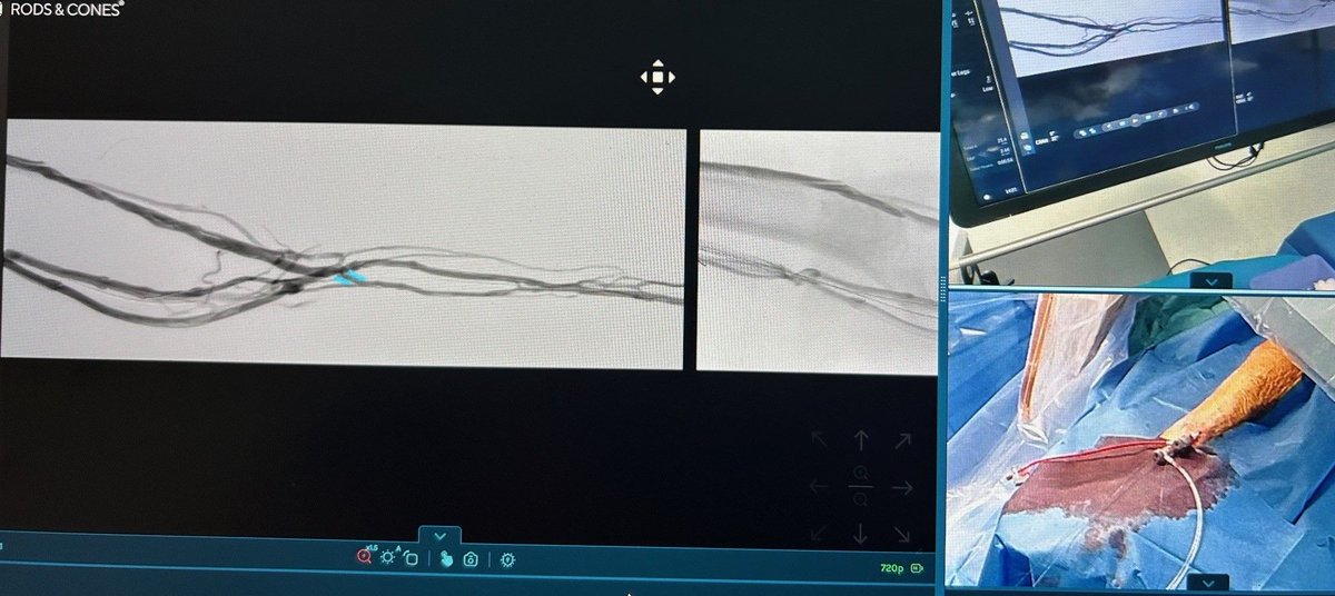 Elevating Training Experience with <a href="/BDandCo/">BD</a> at <a href="/imeldabonheiden/">Imeldaziekenhuis</a>  

👉lnkd.in/dkmMYaxu

#MedicalEducation #RemoteTraining #HealthcareInnovation #telementoring #teleproctoring #smartglasses #digitaltransformation