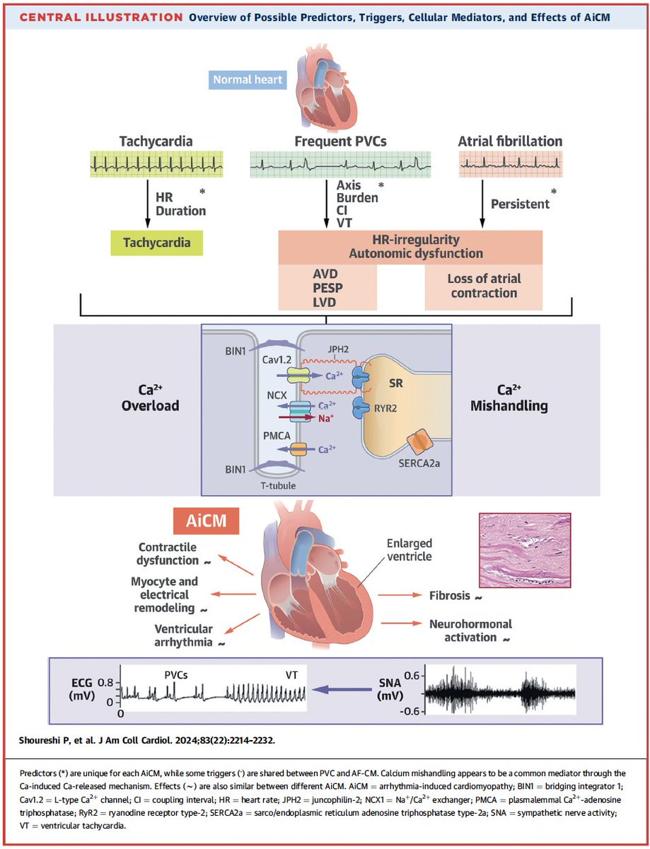 Emanuele Monda (@mondaemanuele) on Twitter photo Arrhythmia-Induced Cardiomyopathy
JACC State-of-the-Art Review
<a href="/JACCJournals/">JACC Journals</a>
jacc.org/doi/10.1016/j.… Arrhythmia-Induced Cardiomyopathy
JACC State-of-the-Art Review
<a href="/JACCJournals/">JACC Journals</a>
jacc.org/doi/10.1016/j.…