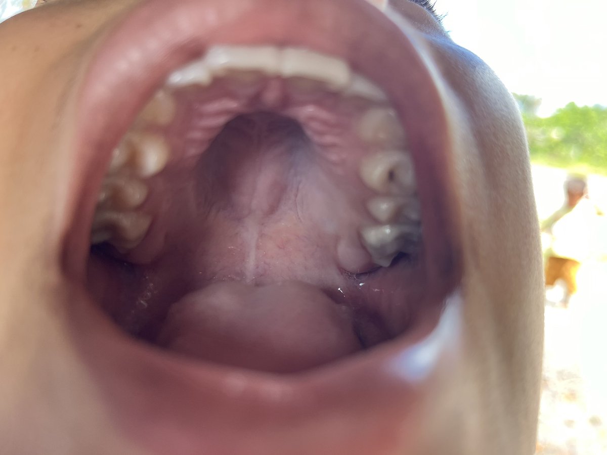HeinCarlos's tweet photo. La tarea en el Amazonas va desde lo odontológico, pasando por salud del cuerpo y compartiendo esperanza a un pueblo que necesita conocer a Jesús! https://t.co/A4uUvEN6Yy
