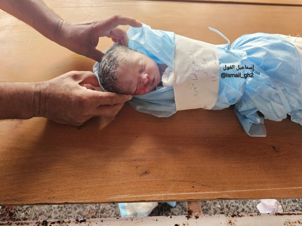 tevfik_hams's tweet photo. Annesi ile birlikte annesinin karnında şehit düştüler!!
bu tamamen soykırımdır.. https://t.co/zvXLSuUgzl