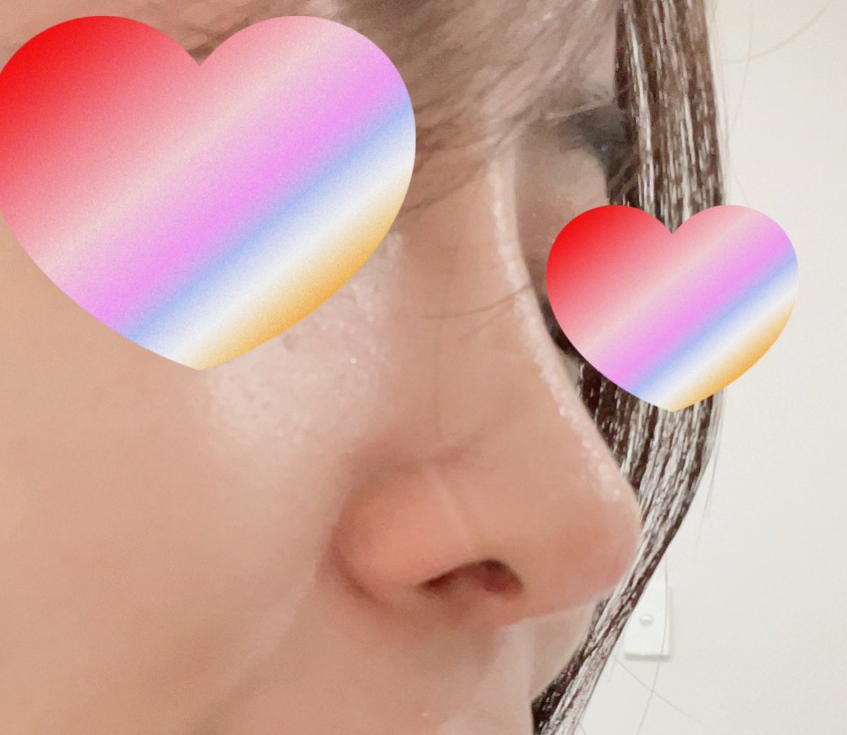 temporary5862's tweet photo. 気がついたら韓国で鼻フルをして1年が経っていました！整形後からいろんな国で過ごしていて日本と同じ環境ではなかったんだけどサプリメントは絶対かかさずどこへ行っても洗顔後はティッシュで拭く。鼻をあんまり触らないを意識して過ごしたら新しい鼻と楽しい1年を過ごすことが https://t.co/hmRm2EFeYt