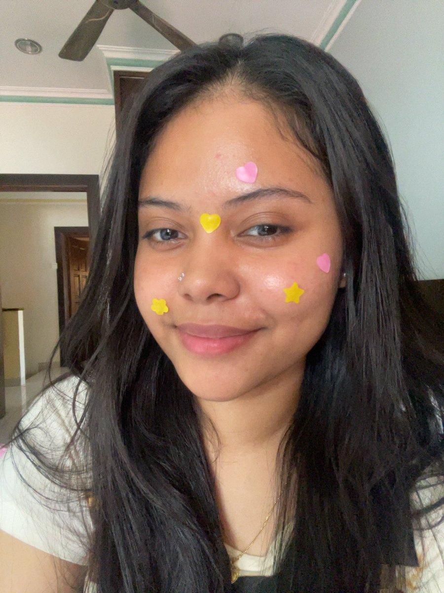 rabyspace's tweet photo. hello @aushmilby you letak apa eh dalam acne patch ni ?

This @tatagaltier #POPPYFLIP works wonder on me ya sampai whitehead i pun terkeluar terkezot i sis 😭😔

from this                       to this https://t.co/mUggKQQtVL