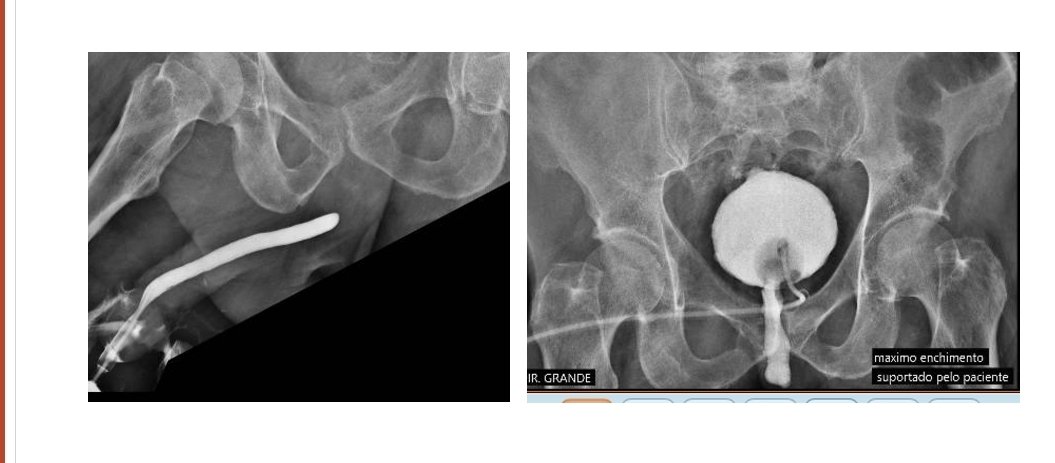 Post Fournier.

Let's go!