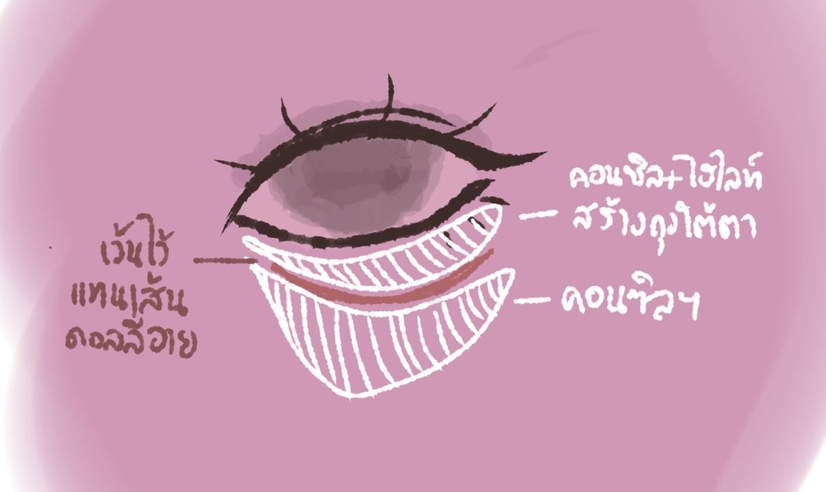 1212_Foxxy's tweet photo. ส่วนตัวมีปัญหาเหมือนกัน ไม่แน่ใจเคยลองกันยัง
   เราใช้เทคนิคไม่เขียนส่วนเงาดอลลี่อายสีน้ำตาลเลย ให้ผิวเราจริงๆเป็นแทนเงาไปเลยจะไม่ลงอะไรรองพื้นลงบางๆเหลือๆจากพัฟ แล้วใช้แค่คอนซีลเลอร์สีสว่างมากๆ+ไฮไลท์สีสว่างสร้างความนูนของดอลลี่อายเอา
อันนี้ฟีลธรรมชาตินัวๆ ถ้าอยากได้พุ่งๆ (ต่อ) https://t.co/VP7KittZwp