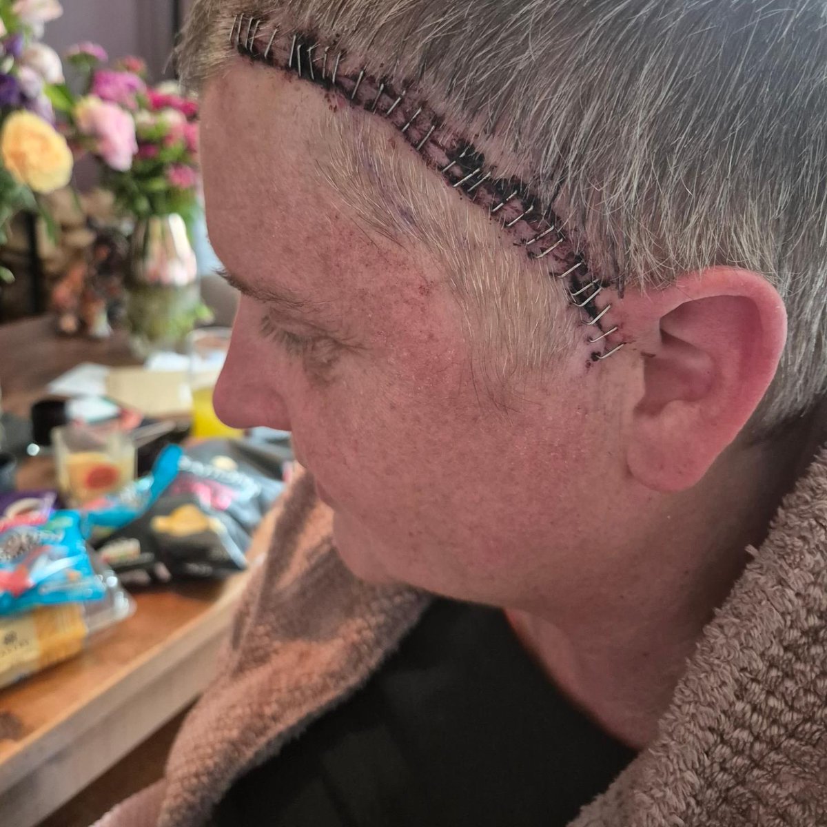ruthxxxxxxx's tweet photo. Time to recover. #brainoperation #scaryshit #theneedtorecover https://t.co/FNllLMY1T5
