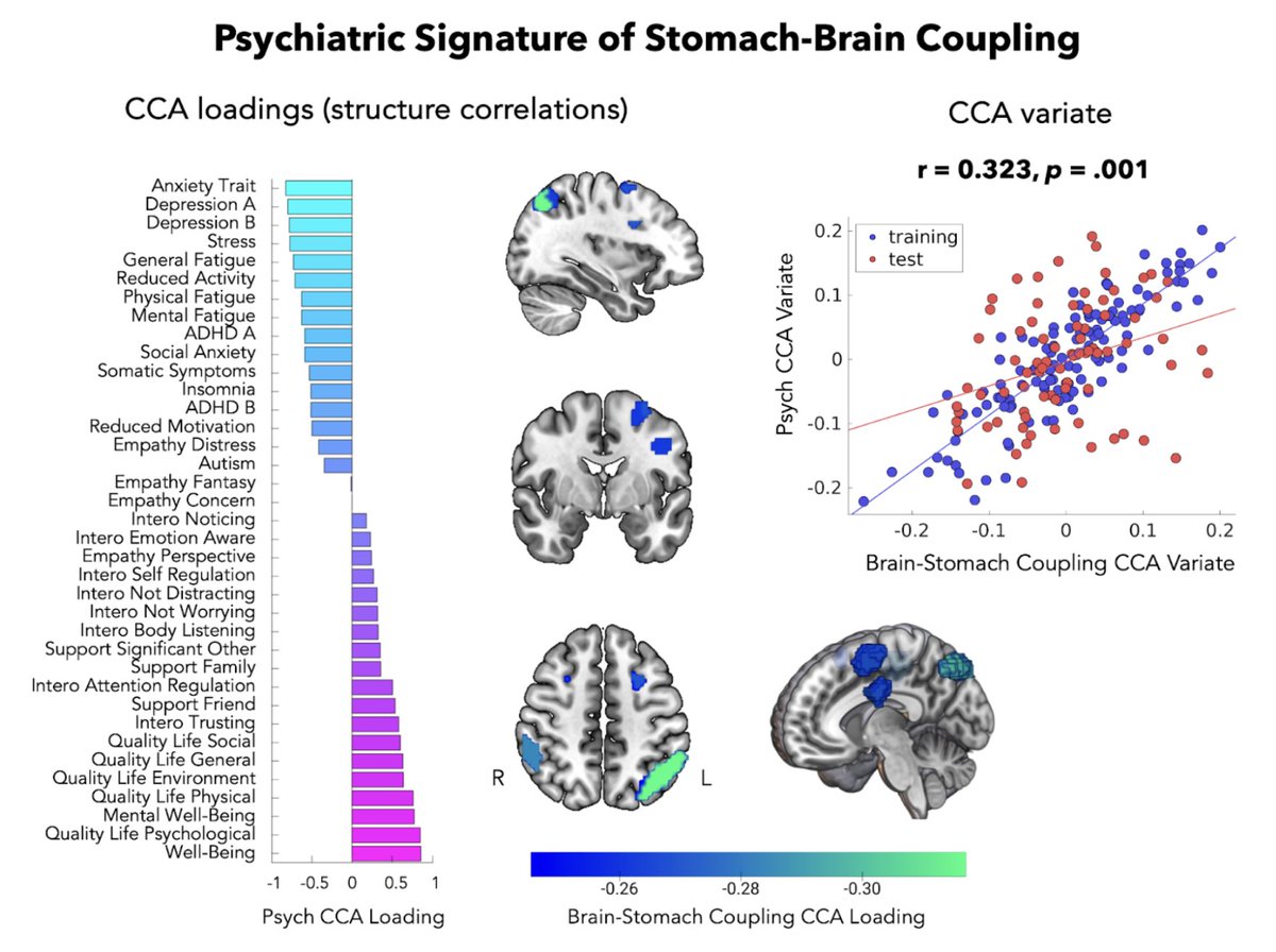 Leah Banellis (@leahbanellis) on Twitter photo <a href="/BrainAndStomach/">Ignacio Rebollo</a> While many believe being ‘more in tune with your body’ improves mental health, we surprisingly found the opposite: worse mental health (higher anxiety, depression, stress, fatigue & reduced well-being)—with stronger stomach-brain connections. <a href="/BrainAndStomach/">Ignacio Rebollo</a> While many believe being ‘more in tune with your body’ improves mental health, we surprisingly found the opposite: worse mental health (higher anxiety, depression, stress, fatigue & reduced well-being)—with stronger stomach-brain connections.