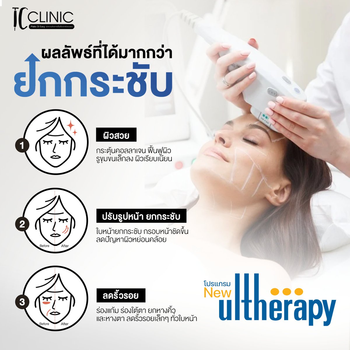 tc_yst's tweet photo. 🔍 รู้หรือไม่ว่าโปรแกรม New Ulthera SPT ได้ผลลัพธ์ที่มากกว่าการยกกระชับ!!

#Ulthera #ปรับรูปหน้า #ยกกระชับหน้าไม่ต้องผ่าตัด #tcclinic https://t.co/Wt4MXn7w2O