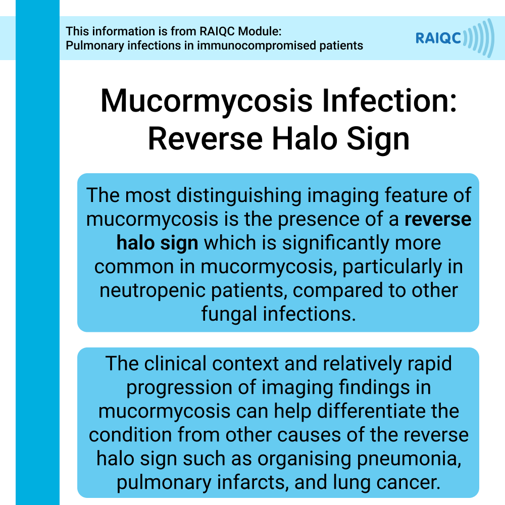 For more content like this, visit our website raiqc.com and access the full FREE educational module!

#radiology #radiologist #medicalimaging #onlineplatform #onlineeducation #radiographer #RAIQC