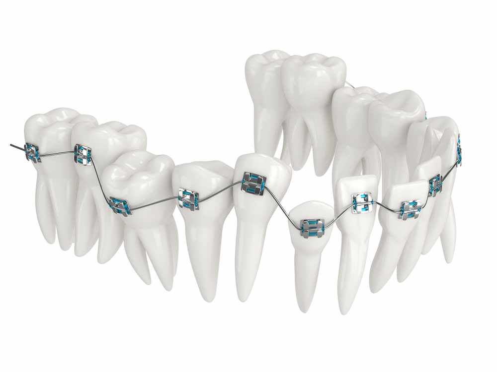 Kevin O'Brien's Orthodontic Blog tweet media