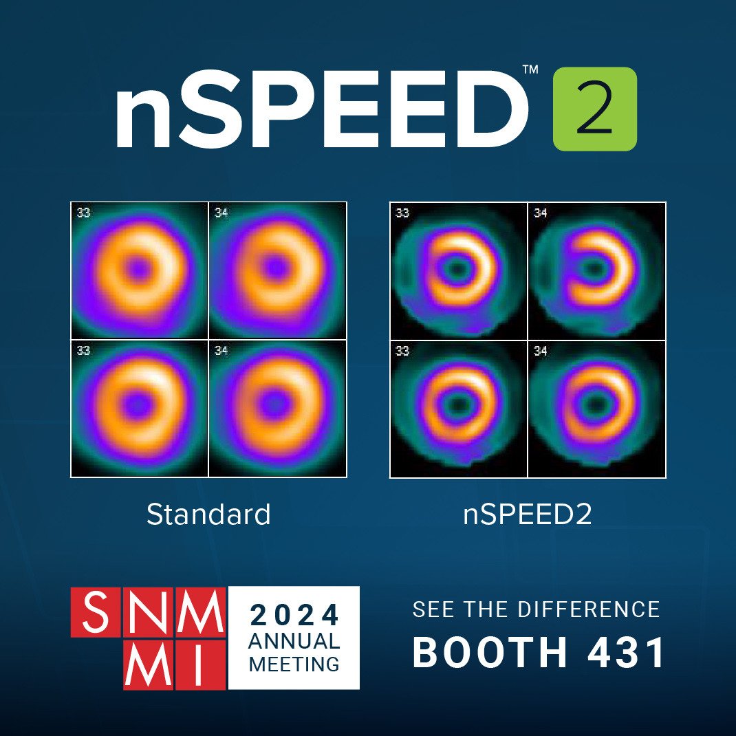 digiradcorp's tweet photo. nSPEED, Digirad’s advanced 3D reconstruction software provides superior image quality over existing 2D reconstruction techniques by producing sharp, high contrast images. Stop by booth 431 and get a closer look at this ground-breaking software! https://t.co/h2rDGF9PGM