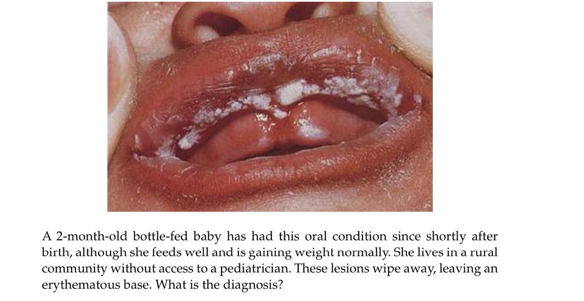 د.عيـسـى بن سـالـم 🇩🇪🇸🇦 tweet media