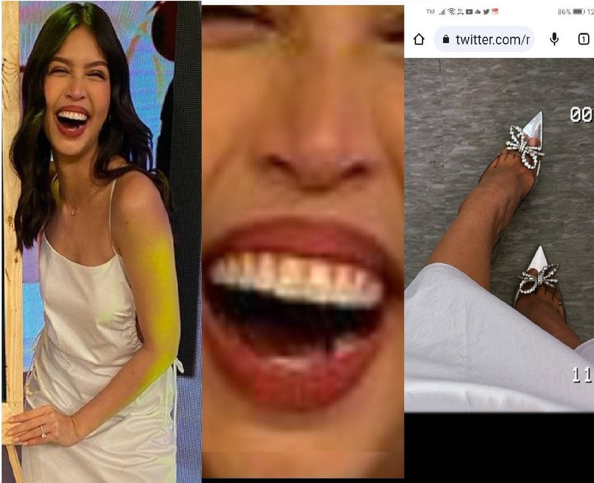 NAALAALA NYO ANG PIX NA ITO?👇👇👇ITO ANG PRE WEDDING NG MAINE WANNABE AT BAKLANG ARJOKLA, TINGNAN NYO ANG BUNGANGA NG BAKLA, CHIPIPAY NA NGA' ANG BRACES  KULANG PA ANG NGIPIN SA IBABA🤣ANG SAPATOS!!😂🤣! ISA ITO SA MALAKING PAGKAKAMALI NG TVJ.  NOT WORTH ANG NADUKWANG NILA SA