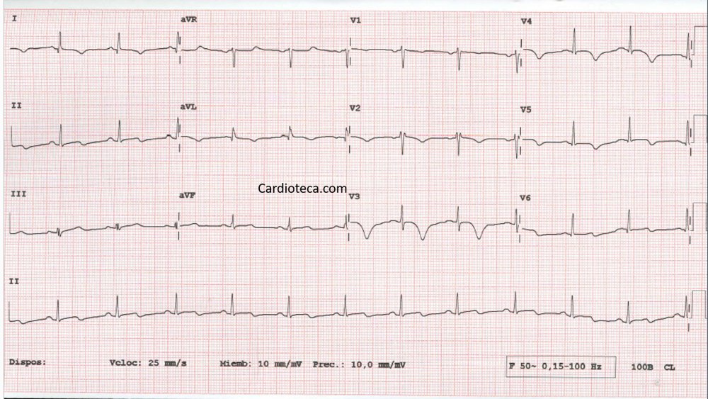 CardioTeca tweet media