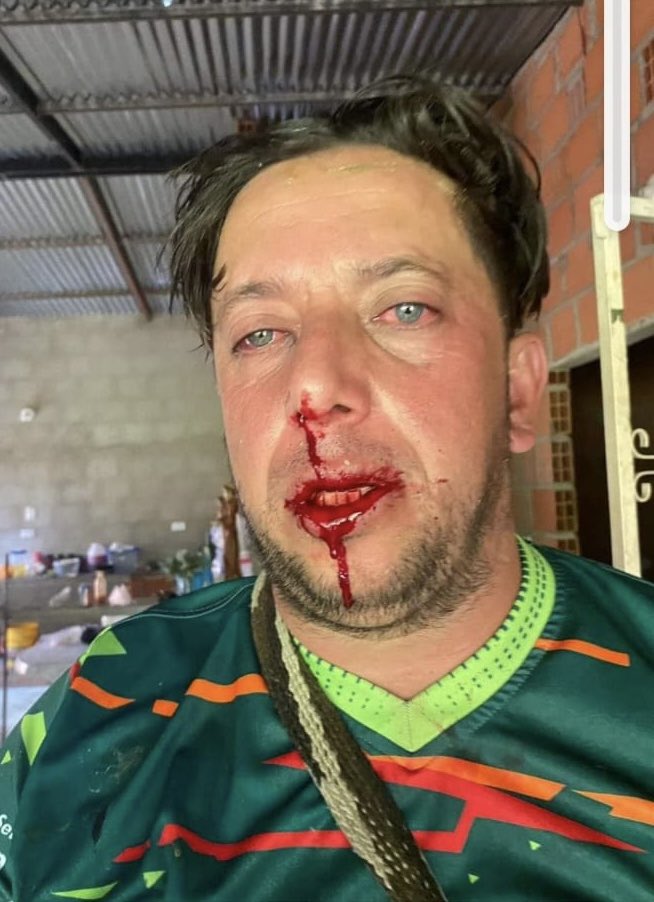 jhonjacome's tweet photo. #ATENCIÓN José Ángel Álvarez, conocido en Ábrego como Chepe Noticias por su famosa página de información sobre el Bello Valle, acaba de ser brutalmente golpeado por Huber Sánchez, alcalde de este municipio. Según la víctima, el mandatario, en compañía de sus hermanos y algunos seguidores, lo golpearon salvajemente mientras jugaba un partido de fútbol. Chepe manifiesta temer por su vida en estos momentos y hace un llamado urgente a las autoridades para que le garanticen su integridad y la de su familia.