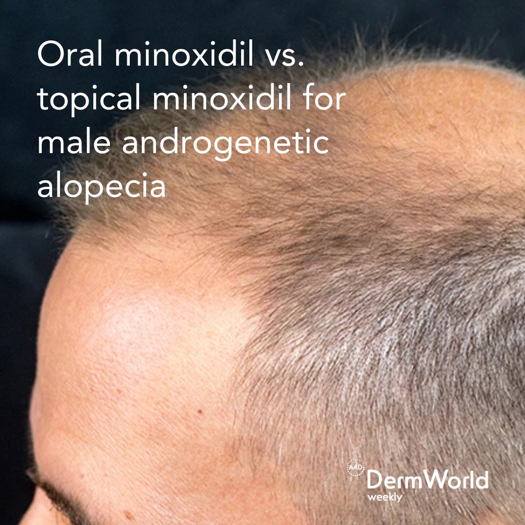 AADmember tweet media