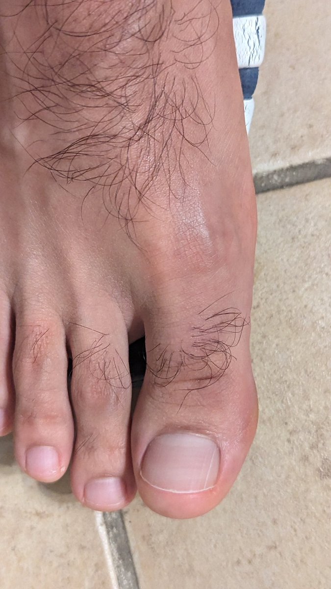latinxfeet7's tweet photo. Hairy 👣 https://t.co/3V4j9QSgqW