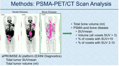 urotoday's tweet photo. Effect of bone marrow disease on hematologic toxicity and PSA response to 177Lu-PSMA-617 therapy. Presentation by Meryam Losee @GWSMHS. #SNMMI24 written coverage by @RKSayyid @UofT > https://t.co/RnW89hsEky @SNM_MI https://t.co/1uhpYyjah2