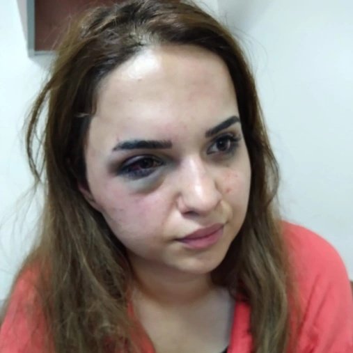solcugazete's tweet photo. Iğdır'da eşi Leyla Akay'a şiddet uygulayan, öldürmekle tehdit eden ve bıçakla yaralayan Sinan Akay, SERBEST bırakıldı. https://t.co/WDVyMGDlT9