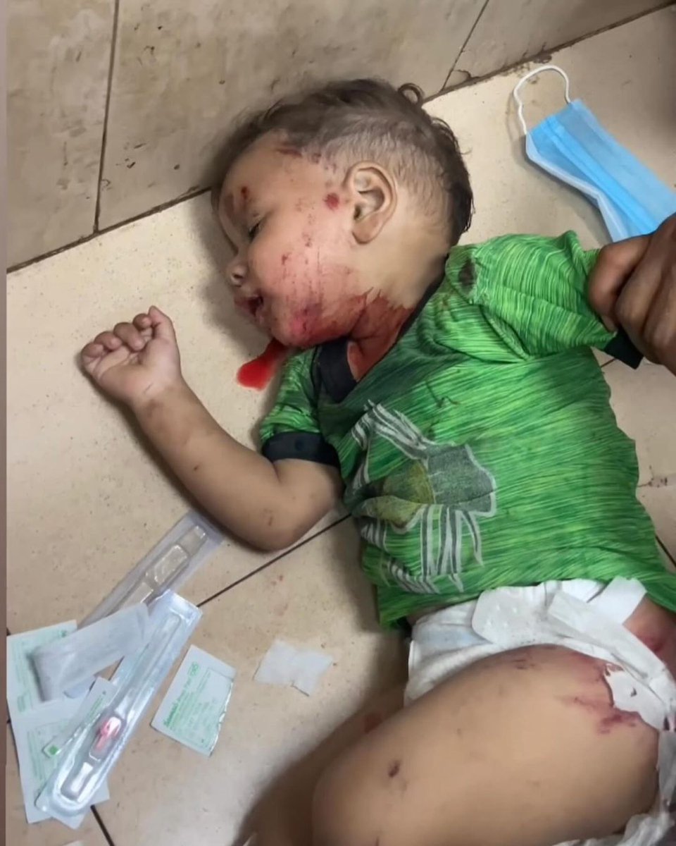 hamad_alnajjar's tweet photo. Terörist İsrail, Gazze'de çocukları hedef almaya devam ediyor. https://t.co/Dga1tUH2Mk