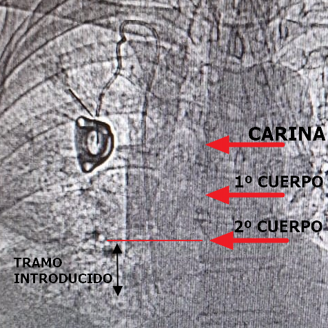 _escoces_'s tweet photo. @GloOrtizMiluy Según esto, diría que queda así https://t.co/2p5AqJtXu5