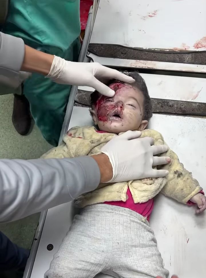 Müslüman, Müslümanın kardeşidir. Ona zulmetmez, onu (zalimlere de) teslim etmez.(Hz Muhammed s.a.v) 

#vanalarıkapattürkiye
#gazze #filistin
#SurvivorAllStar
Gamze Özçelik