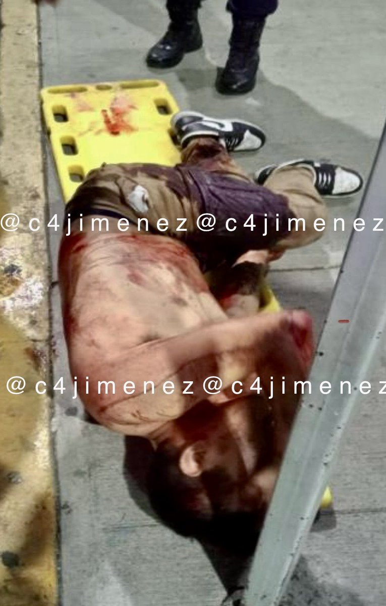 c4jimenez's tweet photo. DETENIDA ACUSADA de BALEAR a 2, EN LA PELIGROSA…
Fda Lizet Noriega
Junto con otro tipo y una amiga andaban así por calles de @Alc_Iztapalapa
Se pelearon con otros dos.
Los dejaron heridos a balazos.
Agentes de @SSC_CDMX los persiguieron.
Sus cómplices la abandonaron.
Así acabó. https://t.co/befGiBH8Dv