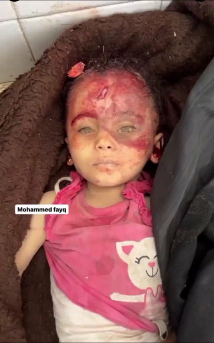 عيونها تشهد على فساله العرب 
#مجزرة_النصيرات_بأيادى_امريكيه