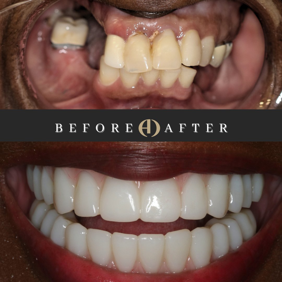 TheArtofDentistrySpa tweet media