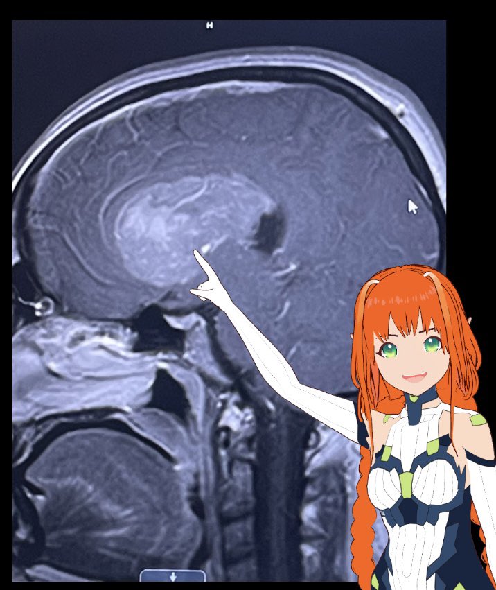 Shrimp Cyberprawn 🦐 tweet media