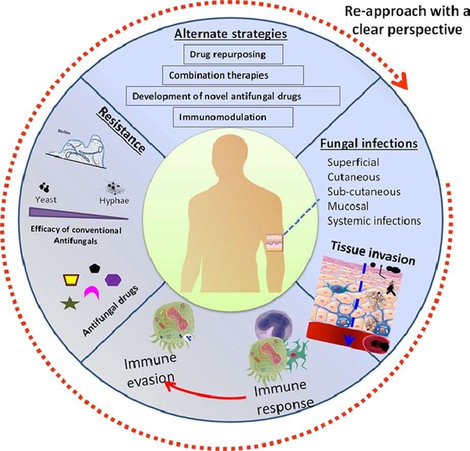 MicrobesInfect's tweet photo. Fungal infections:
Pathogenesis, antifungals and alternate treatment approaches
https://t.co/JMcmzsu0EA #OpenAcccess #mycology #fungi https://t.co/I0RIFYZT1X