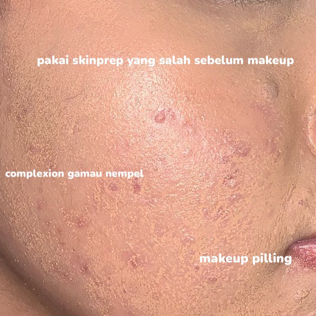 cloudysnowys's tweet photo. NO MORE MAKEUP PILLING OR CAKEY🤡🫵🏻

belajar dari kesalahan gaakan mau lakuin ini lagi sebelum pakai makeup, apalagi pemula wajib tau biar ga ngerasain kaya gini🥲🙏🏻

From this:                               To this: https://t.co/cG6jbnF2hJ