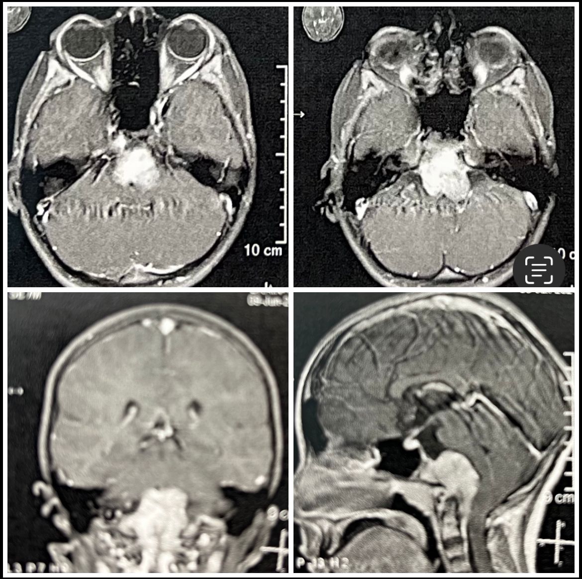 GuiveSharifi's tweet photo. This  patient is 10 year- old (boy) come with neck pain 
Swelling of the right side of the face
What approach do you think is the best ? https://t.co/hoxSqDsbo1