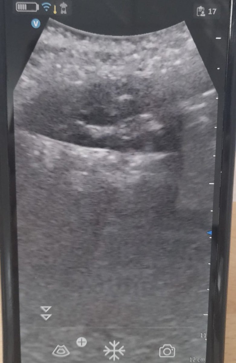 Irish Nephrology Society tweet media